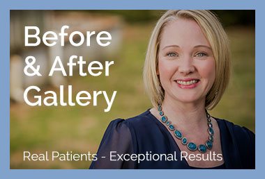 Mammaplasty | Claytor Noone Plastic Surgery | Philadelphia Bryn Mawr