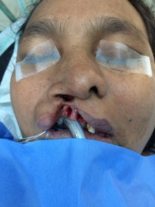 plastic surgery bryn mawr pa | Claytor Noone Plastic Surgery