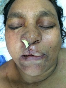 plastic surgery bryn mawr pa | Claytor Noone Plastic Surgery