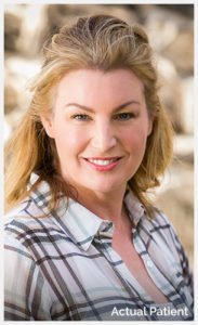 Brow Lift Philadelphia | Plastic Surgery Bryn Mawr PA