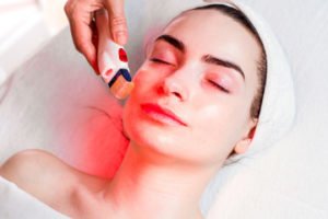 Microneedling Bryn Mawr PA