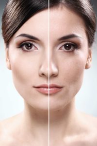 Facelift | Claytor Noone Plastic Surgery | Bryn Mawr PA