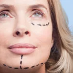 Plastic Surgery Bryn Mawr, PA