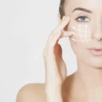 Blepharoplasty Bryn Mawr, PA