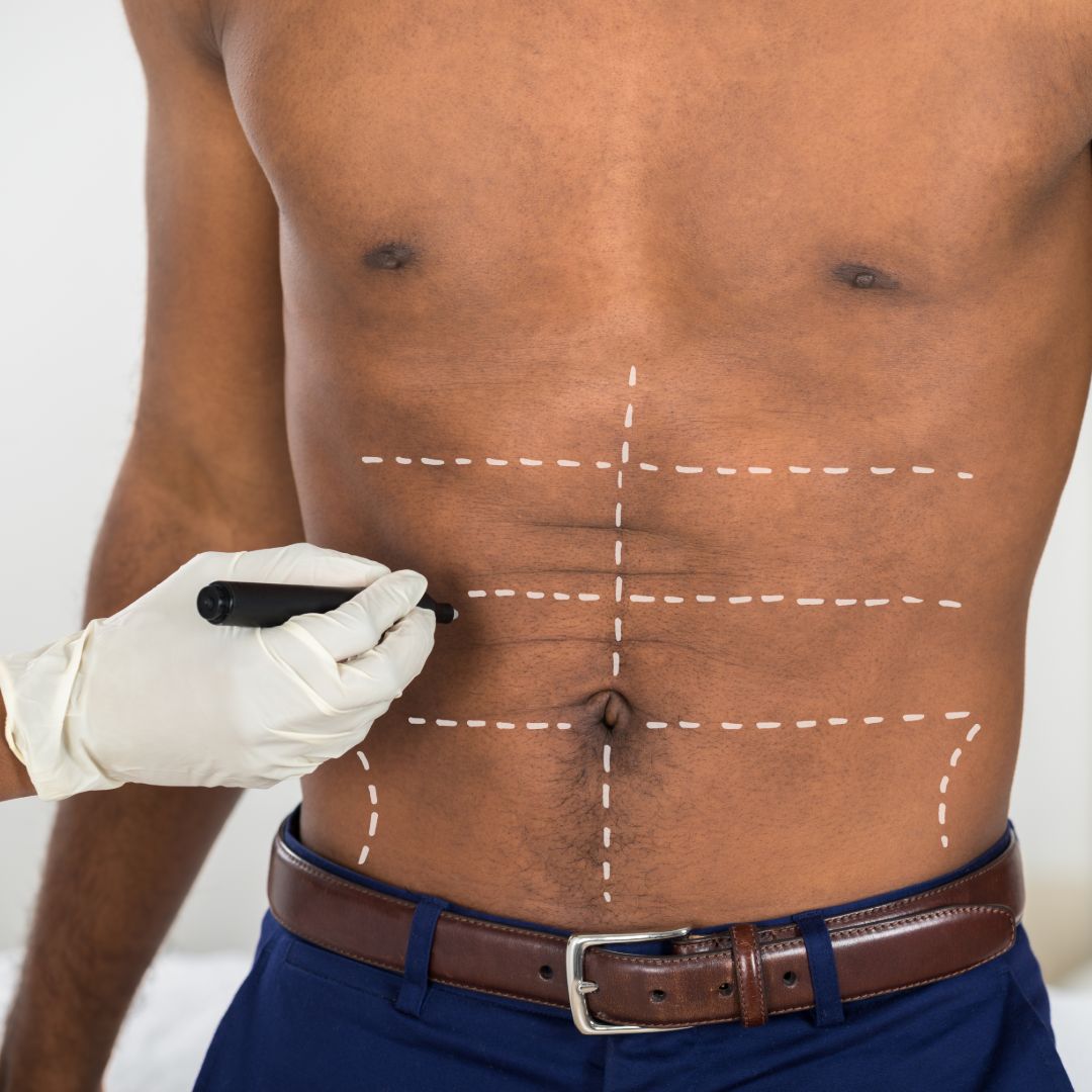 Tummy tuck sales belt reviews 2019