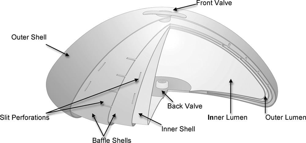 IDEAL Implant diagram