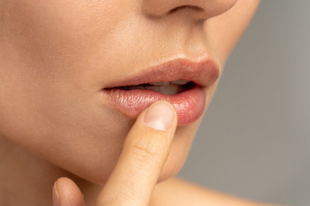 What Is a Lip Lift? Doctors Explain the Plastic Surgery Procedure That  Could Replace Lip Filler