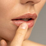 Woman touching her lips after a lip lift with a board certified plastic surgeon