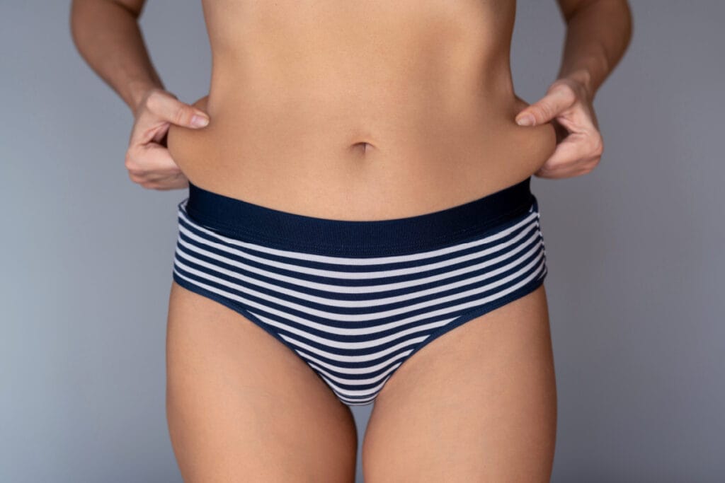 Woman pinching stubborn fat and excess skin on abdomen